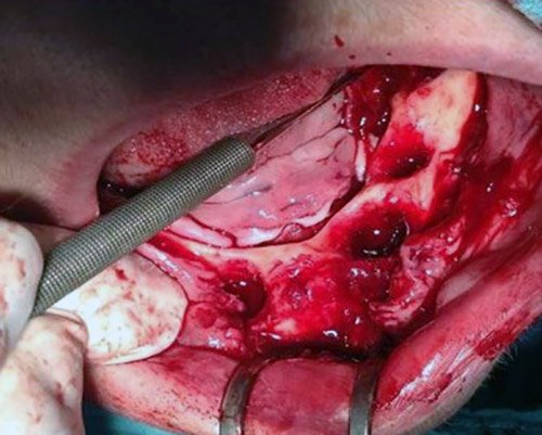 Chirurgia Kosice – Stonek s.r.o. – zubar MUDr. Kucera Jan