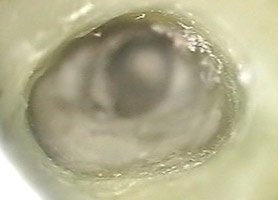 Operacny mikroskop Stonek Kosice - MUDr. Kucera Jan