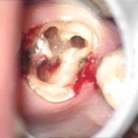 MUDr. Kucera Jan Kosice Stonek - mikroskopicke technologie