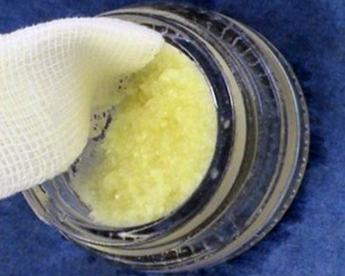 Autologny dentin – dentoalvolarna chirurgia Kosice – Stonek – MUDr. Kucera Jan