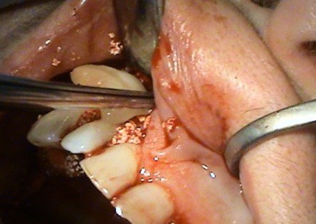 Dentoalveoralna chirurgia – Stonek, Krivá 23, Košice