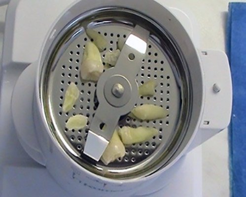 Využitie autológneho dentínu pri augmentácii – Stonek Kosice okolie