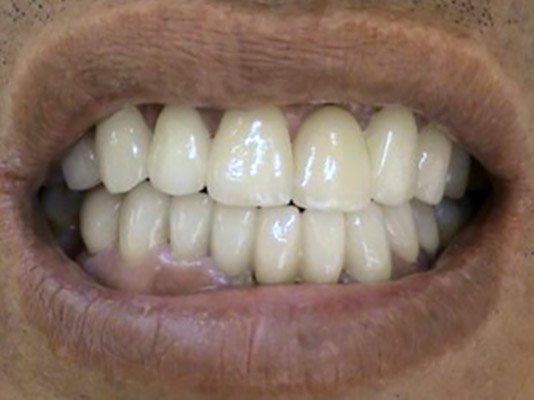 PROTETIKA Liecba celustno – ortopedickych defektov Stonek Kosice