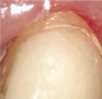 Zubny mikroskop na operacie - Stonek Kosice MUDr. Kucera