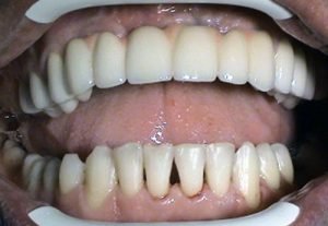 Implantolog Kucera Jan - stomatologia Stonek Kosice